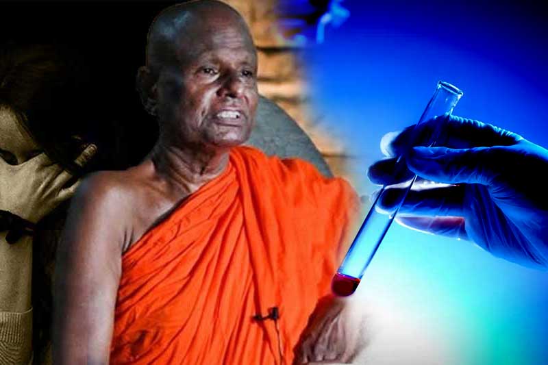 බාලවයස්කාර දැරියක් අපයෝජන සිද්ධිය :                                               DNA පරීක්ෂණයක් සඳහා පල්ලේගම හේමරතන හිමිගෙන්                      රුධිර සාම්පල ලබා ගනී